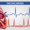 Tachicardia: quando può essere pericolosa?
