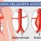 Aneurisma dell’aorta addominale