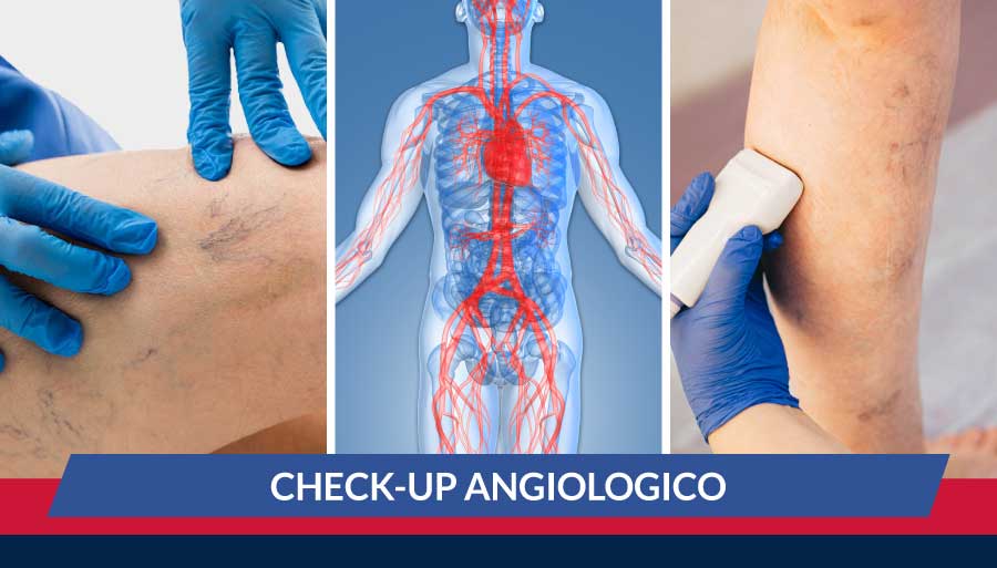 check-up-angiologico-cardiocenter-napoli