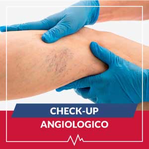 check-up-angiologico