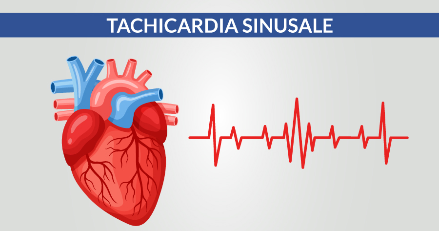 tachicardia-sinusale