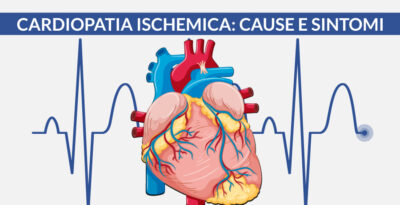 Cardiopatia ischemica: cause e sintomi