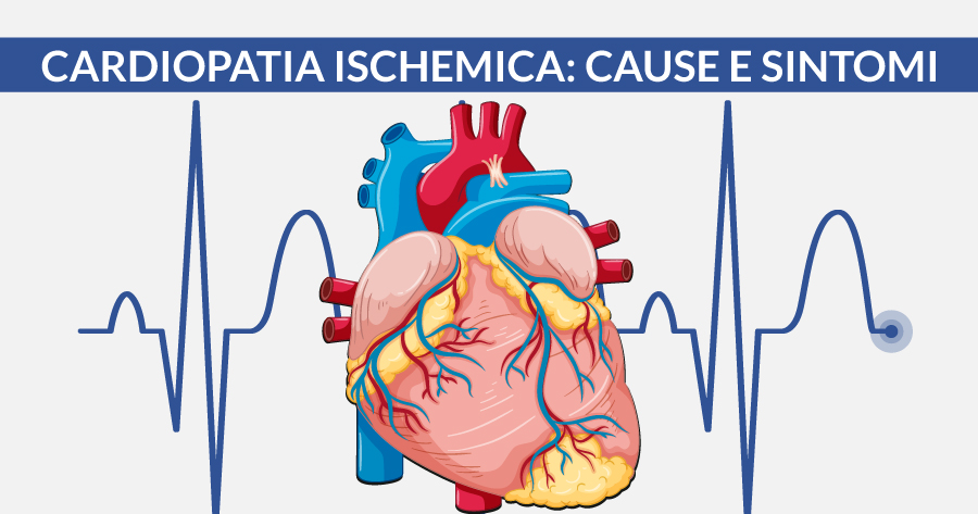 cardiopatia-ischemica-cause-sintomi.cardiocenter