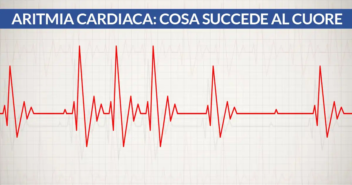 aritmia cardiaca: cosa succede al cuore cardiocenter